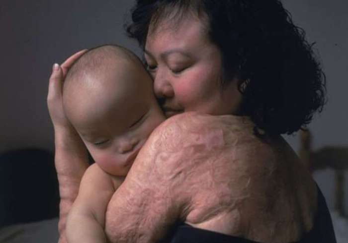 Kim Phuc y su nieto (2017)